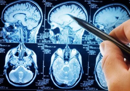 تأثیر فقر و وضع نامناسب مالی بر آناتومی مغز انسان